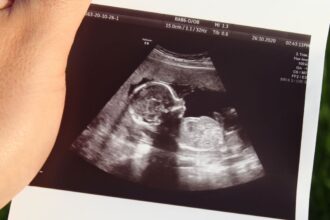 legatura dintre diabetul in timpul sarcinii si riscul de autism sau adhd al fatului 67f8dac238e0d