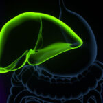 Un nou tratament promite să înlocuiască transplantul hepatic în afecțiunile căilor biliare 3 un medicament ar putea elimina necesitatea transplantului hepatic in afectiuni ale cailor biliare 680d56f14bbcb