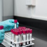 Un simplu test de sânge ar putea anticipa boala Parkinson înainte ca simptomele să se facă simțite! 2 un test de sange ar putea detecta boala parkinson inainte de aparitia simptomelor 67fb5cf863e49