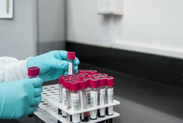 Un simplu test de sânge ar putea anticipa boala Parkinson înainte ca simptomele să se facă simțite! 1 un test de sange ar putea detecta boala parkinson inainte de aparitia simptomelor 67fb5cf863e49