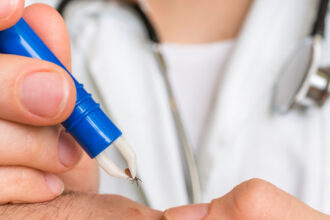 cum scoti corect o capusa si cand trebuie sa mergi la medic avertismentul specialistilor nu se folosesc substante pe piele 68368cb722712
