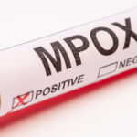 macedonia de nord a raportat primele sale doua cazuri de infectare cu mpox apelul autoritatilor catre cetateni 683093e30538d