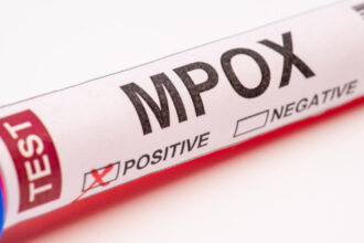 macedonia de nord a raportat primele sale doua cazuri de infectare cu mpox apelul autoritatilor catre cetateni 683093e30538d