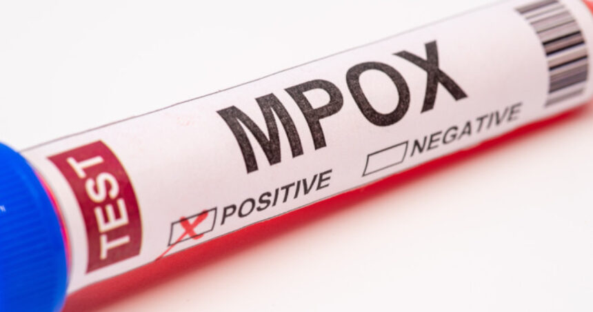 Macedonia de Nord anunță primele cazuri de mpox: Mesajul autorităților pentru populație 1 macedonia de nord a raportat primele sale doua cazuri de infectare cu mpox apelul autoritatilor catre cetateni 683093e30538d