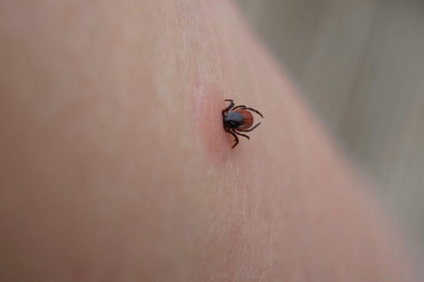 zeci de oameni au ajuns la spital cu muscaturi de capuse sfaturile autoritatilor de sanatate publica 681e1b6737851