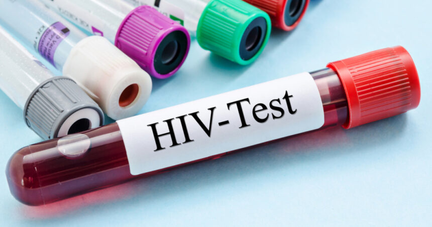Cercetătorii din Australia, încântați de rezultatele unui tratament revoluționar pentru HIV. O descoperire ce ar putea înfrunta virusul decisiv! 1 cercetatorii australieni uluiti de efectele unui nou tratament contra hiv descoperirea care ar putea duce la eradicarea virusului 684510f60f689