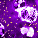 Între adaptare și distrugere: Povestea fascinantă a celei mai mortale bacterii care a provocat milioane de victime de-a lungul timpului și a reușit să supraviețuiască până în prezent 2 cum a evoluat cea mai letala bacterie din toate timpurile ca sa continue sa omoare milioane de oameni si sa supravietuiasca pana astazi 683e83ca763c8
