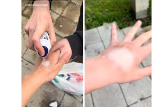 trend periculos pe tiktok provocarea deodorantului va poate lasa semne pe piele pentru toata viata 685d8f8f6baf9