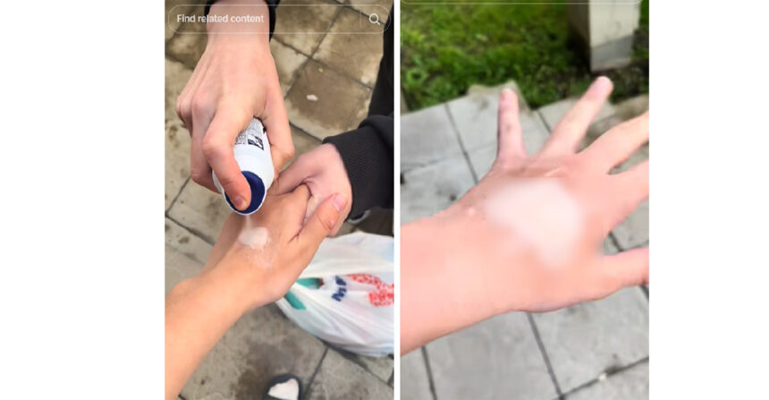 Provocarea Deodorantului pe TikTok: Riscuri Ascunse care Pot Strica Pielea pe Viață! 1 trend periculos pe tiktok provocarea deodorantului va poate lasa semne pe piele pentru toata viata 685d8f8f6baf9