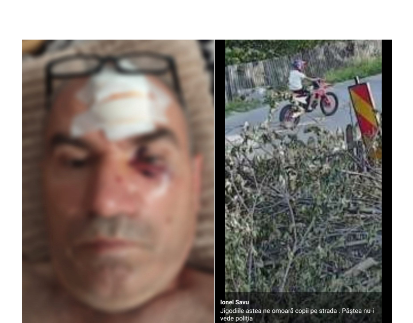 Bătăi în Lipnița: Un conflict izbucnit pe Facebook se transformă într-o confruntare violentă între vecini. Ce s-a întâmplat? 1 un barbat din lipnita batut mar de un consatean dupa o postare pe facebook ce s a intamplat 68455615522f5