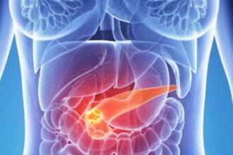 un nou test ar putea depista cancerul pancreatic in stadiile initiale 6851c299ad9ab