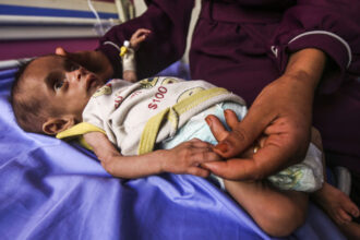 galerie foto infometare in masa numarul copiilor subnutriti din gaza cu varste sub 5 ani s a triplat in ultimele doua saptamani 6883ef2755979