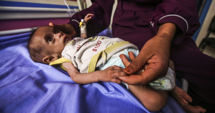 „Criza Fiarei Foamei: Triplicarea copiilor sub 5 ani afectați de subnutriție în Gaza, în ultimele două săptămâni” 1 galerie foto infometare in masa numarul copiilor subnutriti din gaza cu varste sub 5 ani s a triplat in ultimele doua saptamani 6883ef2755979