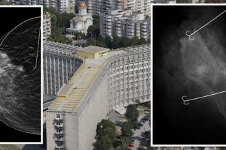 premiera medicala in patologia mamara la spitalul clinic judetean de urgenta constanta 689369240f2ed