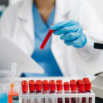 O analiză de sânge promite să identifice cancerul ovarian în faze timpurii cu o precizie remarcabilă (studiu) 3 un test de sange ar putea depista cu precizie cancerul ovarian in stadii incipiente studiu 68ad7a0298a32