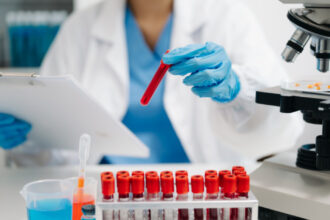 un test de sange ar putea depista cu precizie cancerul ovarian in stadii incipiente studiu 68ad7a0298a32