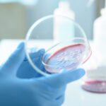 Serratia marcescens: Bacteria misterioasă identificată la Spitalul „Sfânta Maria” din Iași, legată de tragedia celor șase copii 2 ce este serratia marcescens bacteria descoperita la spitalul sfanta maria din iasi unde au murit sase copii 68d69438bd5f1