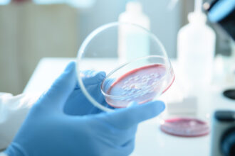 ce este serratia marcescens bacteria descoperita la spitalul sfanta maria din iasi unde au murit sase copii 68d69438bd5f1