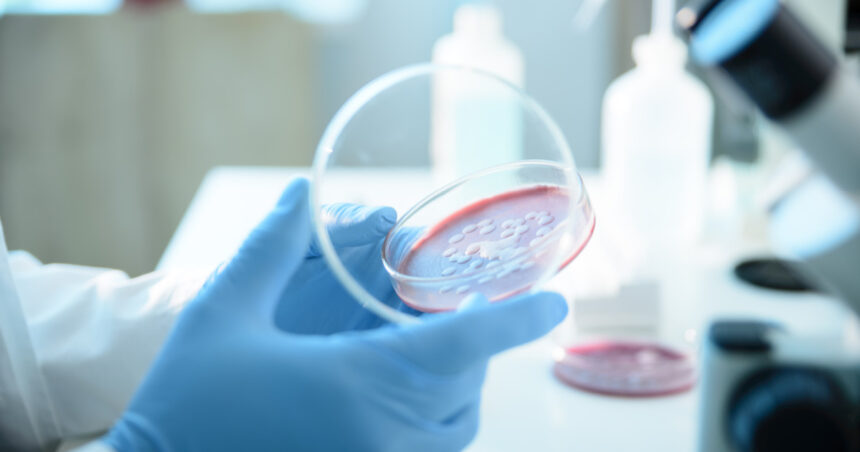 Serratia marcescens: Bacteria misterioasă identificată la Spitalul „Sfânta Maria” din Iași, legată de tragedia celor șase copii 1 ce este serratia marcescens bacteria descoperita la spitalul sfanta maria din iasi unde au murit sase copii 68d69438bd5f1