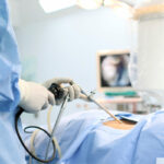 Chirurgia laparoscopică – arta medicală a vindecării cu impact redus asupra corpului 3 chirurgia laparoscopica medicina moderna care aduce vindecare cu trauma minima 68cd69ee1d6cf