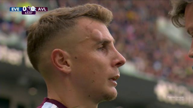 Eroul rundei în Premier League: a continuat să joace cu o umflătură cât o minge de golf! 1 foto si video eroul etapei in premier league a insistat sa joace cu o umflatura de marimea unei mingi de golf 68c681a10be46