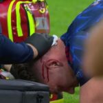 Viktor Gyokeres, debut dramatic în Champions League împotriva lui Arsenal: Detalii despre accidentarea șocantă! 2 galerie foto viktor gyokeres accidentare horror la debutul in champions league cu arsenal ce s a intamplat 68c9b5713e0e0