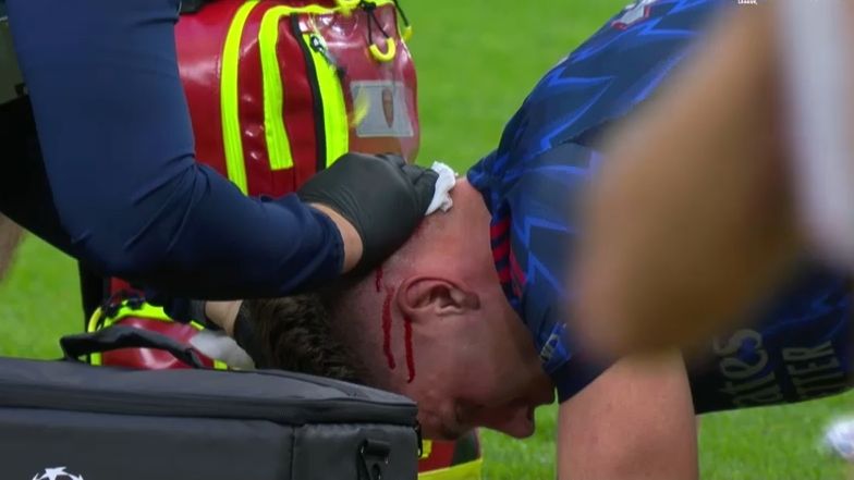 Viktor Gyokeres, debut dramatic în Champions League împotriva lui Arsenal: Detalii despre accidentarea șocantă! 1 galerie foto viktor gyokeres accidentare horror la debutul in champions league cu arsenal ce s a intamplat 68c9b5713e0e0
