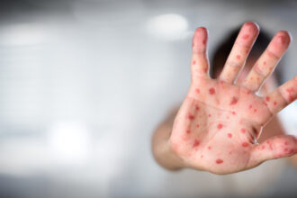 lupta oamenilor lui trump cu stiinta vaccinul contra rujeolei nu mai este recomandat contrar avizelor medicilor 68cd1a60bf155