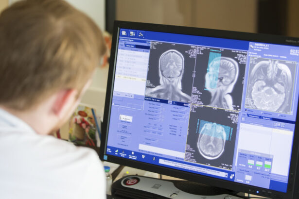 povestea gemenilor diagnosticati cu aceeasi boala extrem de rara la 8 ani distanta nici medicii nu inteleg cum a fost posibil 68c4fccc27c8b