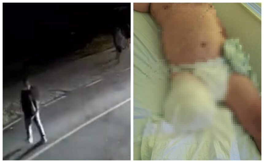 Imagini tulburătoare din accidentul de la Oltina, în urma căruia un bărbat și-a pierdut un picior 1 video imagini cu puternic impact emotional din timpul producerii accidentului de la oltina unde un barbat a ramas fara un picior 68c7c47ec8906