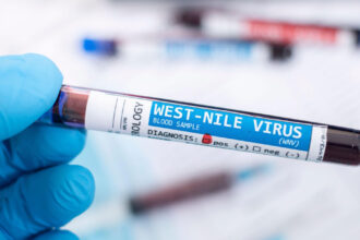 video restrictii la donarea de sange in judetele cu cazuri confirmate de west nile ce trebuie sa stie donatorii 68bbf6f2b76cb