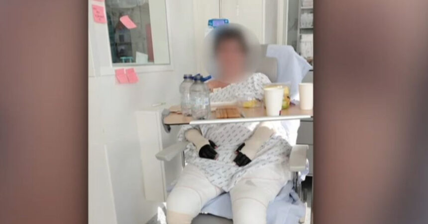 O poveste de curaj care a determinat autoritățile să-și admită greșelile: Lavinia, pacienta cu arsuri de la Floreasca, se pregătește să se întoarcă acasă din Belgia. 1 povestea care a facut statul sa si recunoasca greselile lavinia pacienta cu arsuri de la floreasca trimisa in belgia va fi externata 68ee139f4491c