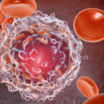 descoperire majora cercetatorii au reusit sa elimine complet leucemia in modele preclinice 690622d45c4c7