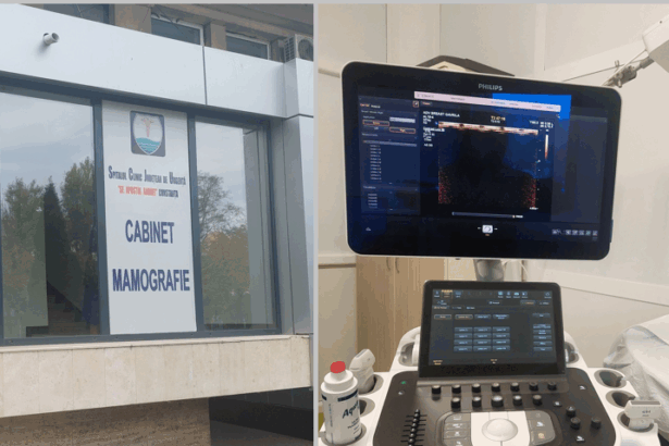 foto spitalul judetean constanta a achizitionat un ecograf unic in romania pentru depistarea precoce a cancerului de san 6917849d84445