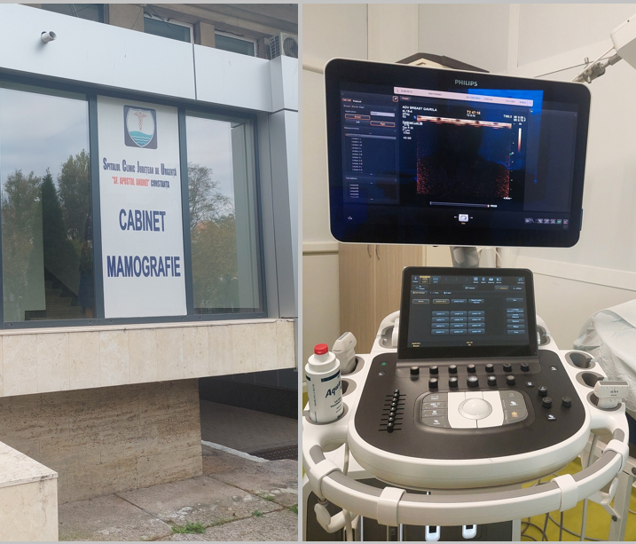 foto spitalul judetean constanta a achizitionat un ecograf unic in romania pentru depistarea precoce a cancerului de san 6917849d84445