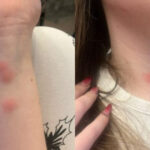 video o tanara a ajuns la spital dupa ce a fost muscata de plosnite intr un tren cfr familia a facut plangere 6922d308a1fa3