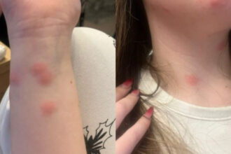 video o tanara a ajuns la spital dupa ce a fost muscata de plosnite intr un tren cfr familia a facut plangere 6922d308a1fa3