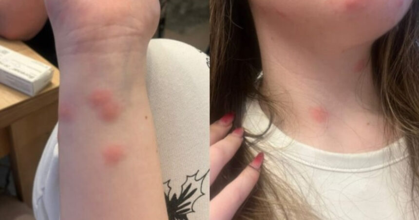 video o tanara a ajuns la spital dupa ce a fost muscata de plosnite intr un tren cfr familia a facut plangere 6922d308a1fa3