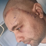 mihai un tanar din mangalia are nevoie urgenta de ajutor pentru a lupta cu boala nemiloasa care ii macina sanatatea 692e971a7ab2e