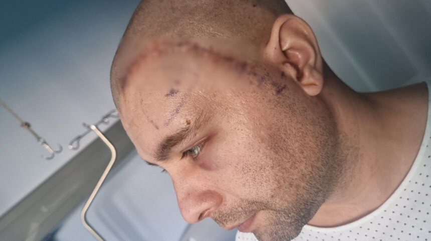 mihai un tanar din mangalia are nevoie urgenta de ajutor pentru a lupta cu boala nemiloasa care ii macina sanatatea 692e971a7ab2e