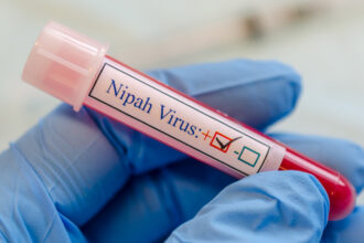 ce este virusul nipah care a declansat controale de securitate pe aeroporturile din asia ce riscuri exista pentru romania 6979f5a95ad97