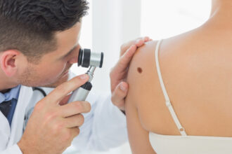 cum identifici alunitele cu risc de cancer dermatologii explica semnele importante care necesita evaluare urgenta 697482048b849