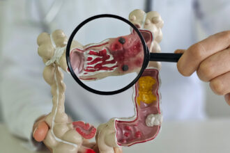 metoda prin care specialistii vor sa descopere de ce tot mai multi tineri sunt diagnosticati cu cancer o resursa unica 696330f735fa6