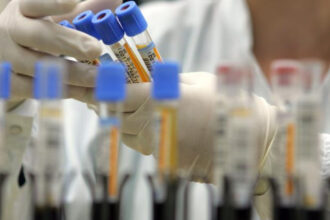 speranta noua in lupta cu cancerul pancreatic combinatia de trei medicamente care opreste boala 697de69954e4a
