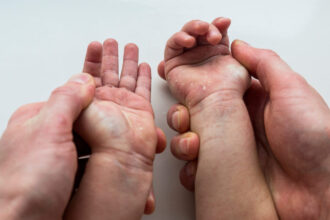 dermatita atopica la copii ghid complet pentru parinti 699bf5bb6c7d7