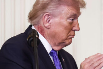 noi intrebari despre starea de sanatate a lui donald trump ce este pata rosie aparuta pe gatul presedintelui american 69a5fcb80ad34