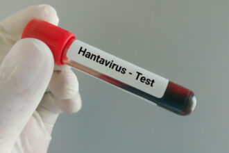 video tanarul din arad suspect de hantavirus a fost confirmat pozitiv ce spun autoritatile despre tulpina virusului 6a0adaf92b3e6
