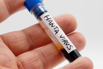 ancheta epidemiologica in argentina noua varianta de hantavirus identificata la rozatoare fara legatura cu focarul de pe mv hondius 6a42b50fafc62