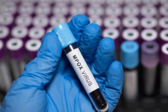 doi oameni de stiinta acuzati ca au adus ilegal in sua fiole cu virus mpox dezactivat din africa si au mintit autoritatile 6a214f10486d3