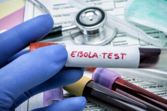 alerta in marea britanie suspiciune de ebola intr un spital din glasgow 6a44cb768469b